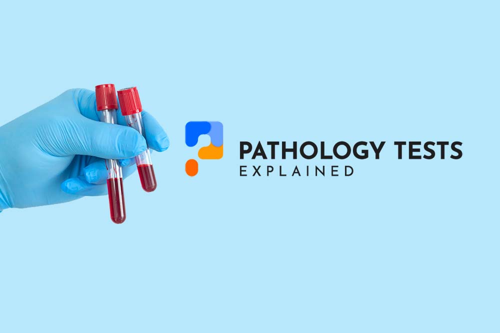 Pathology Tests Explained eresource